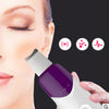 Ultrasonic Facial Scrubber / Pore Cleaner - Blindly Shop